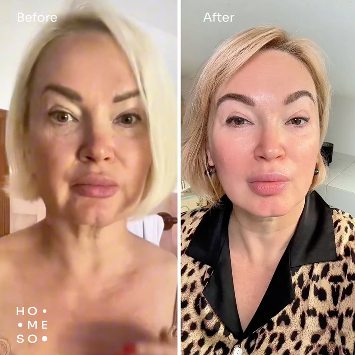 Результати до і після — Катаріна С.