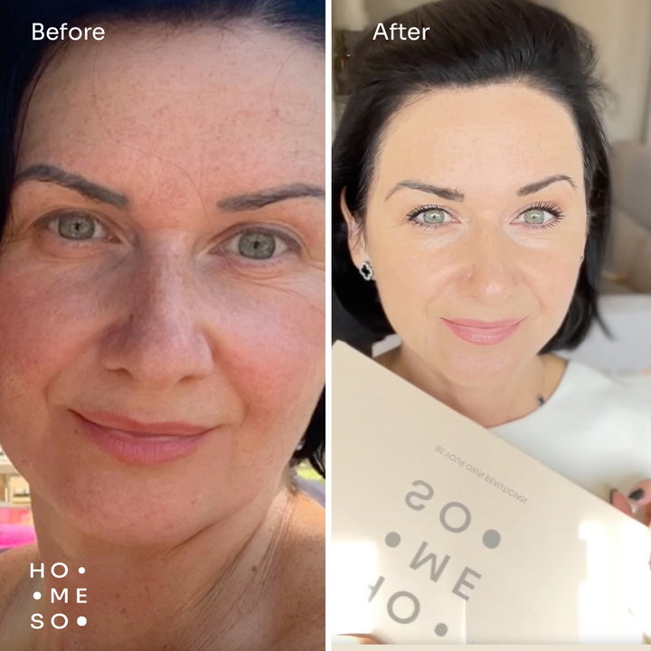 Результати до і після — Ана К.