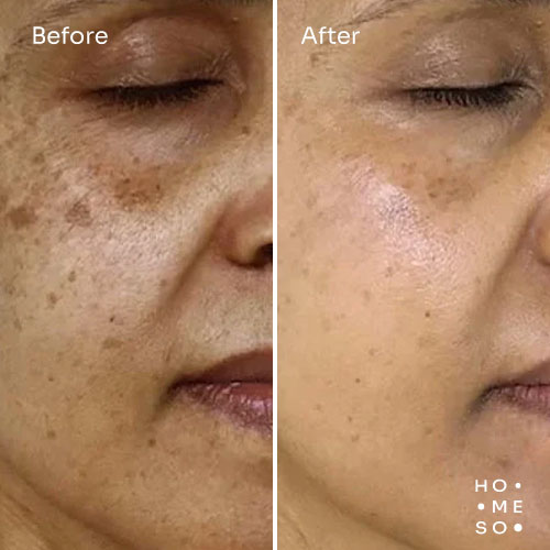 До і після — покращення в ділянці обличчя