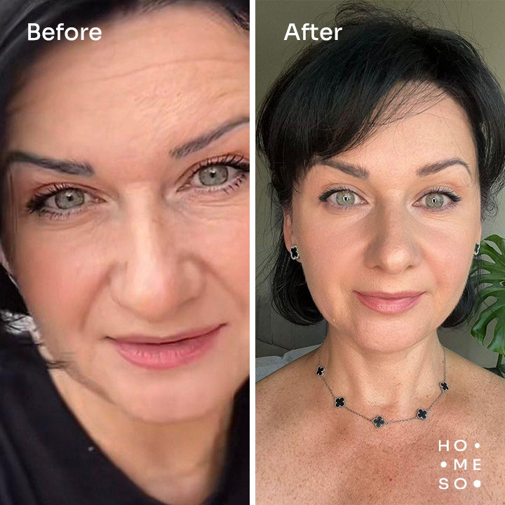 Фото клієнта HoMEso 2