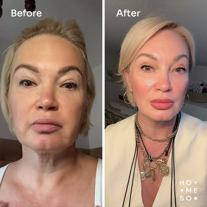 Фото клієнта HoMEso 3