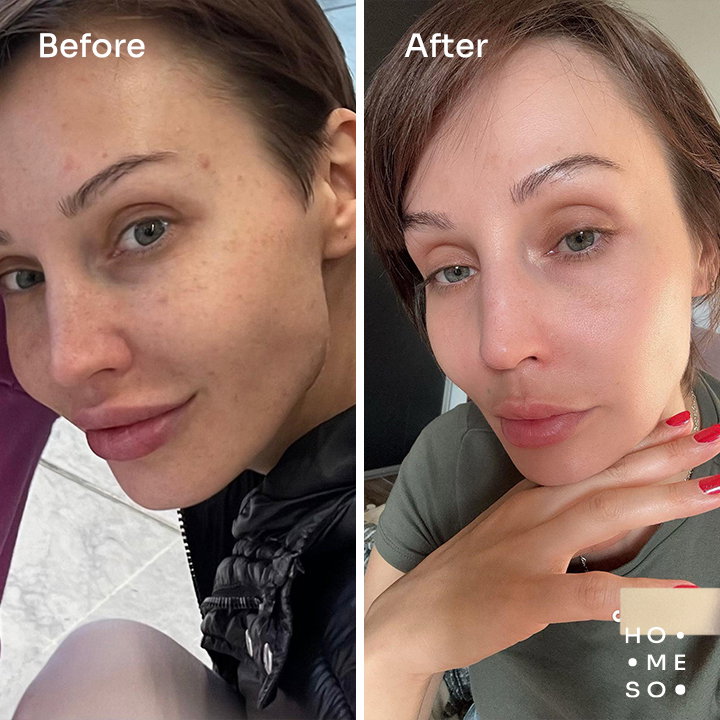 Результати до і після — Олена П.