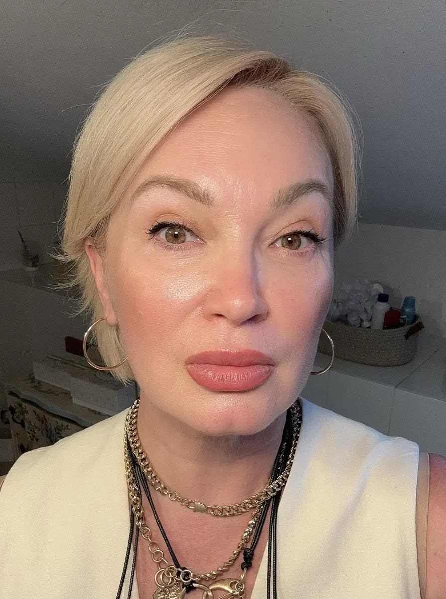 Результаты преображения кожи до и после