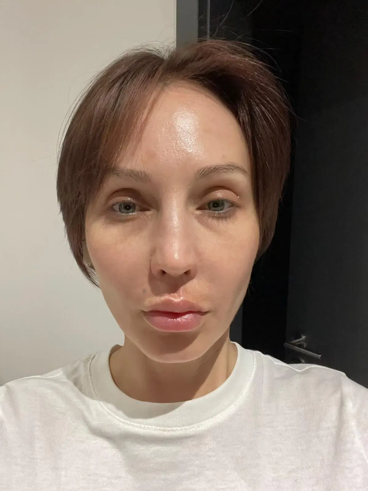 Результаты до и после HoMEso