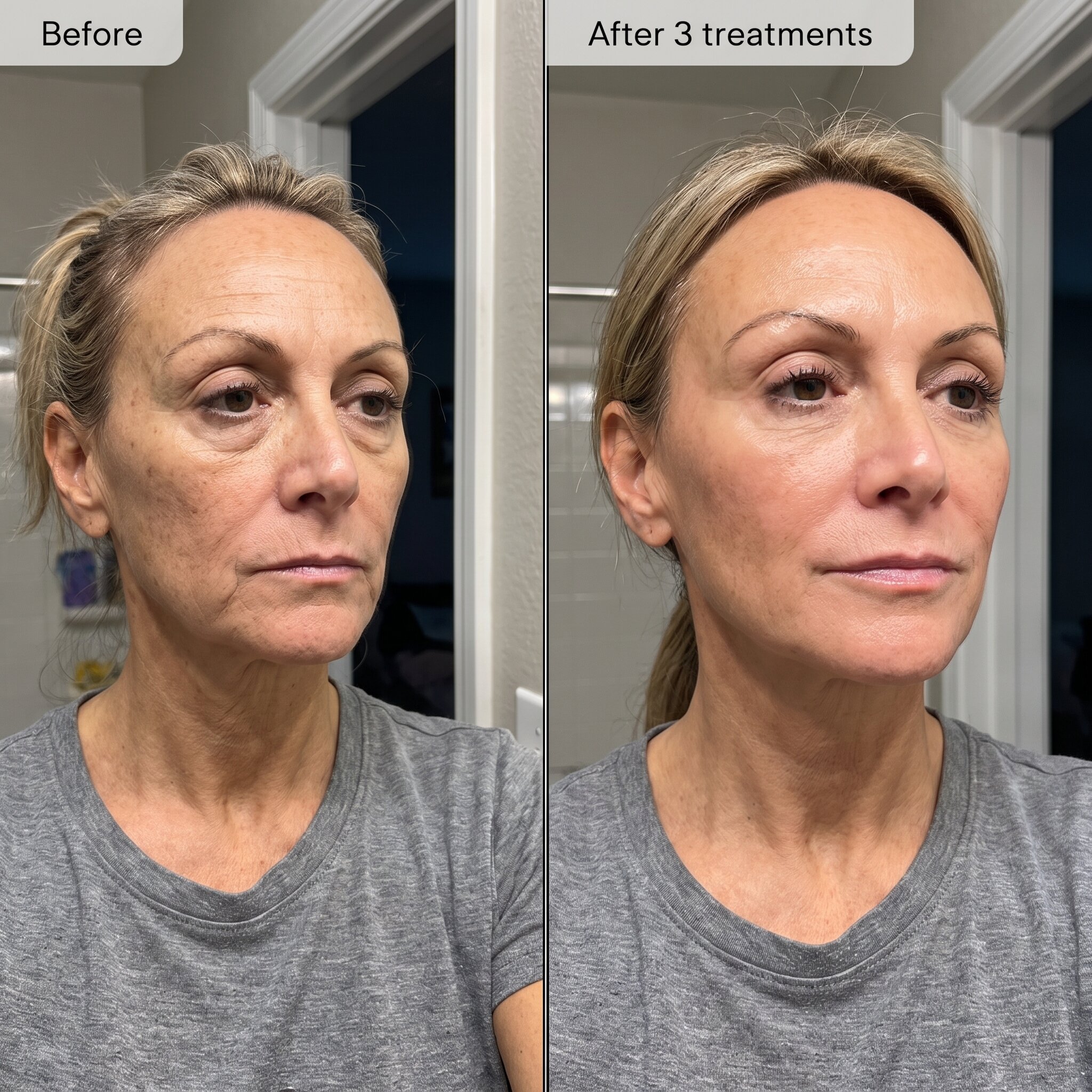 Skincare goal