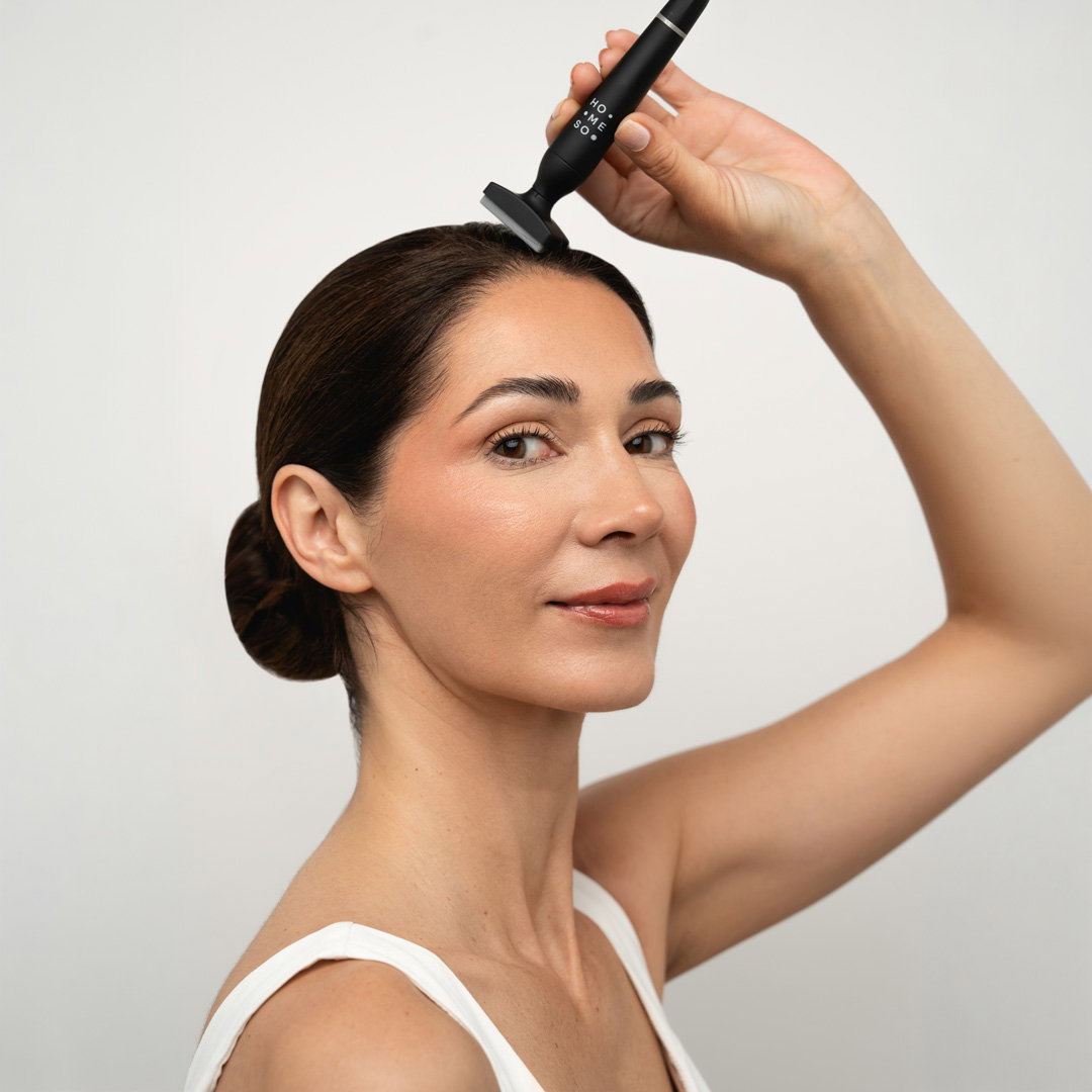Woman using the HoMEso Micro Stamp on her scalp at the hairline